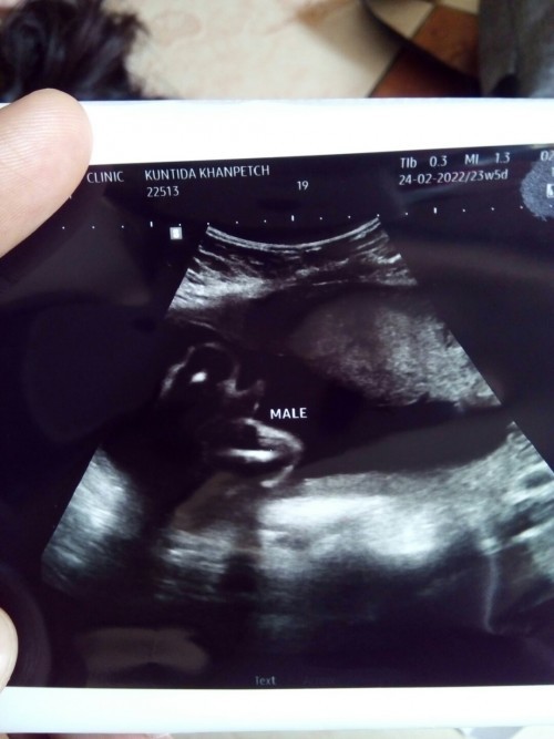 Post reply image