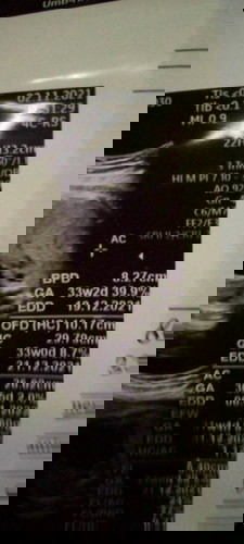 Cara liat berat badan bayi dan panjang ya