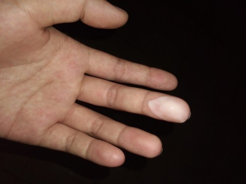 มันคืออะไรค่ะแม่ๆ