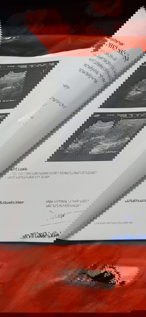 Mom tập đầu xin ý kiến###