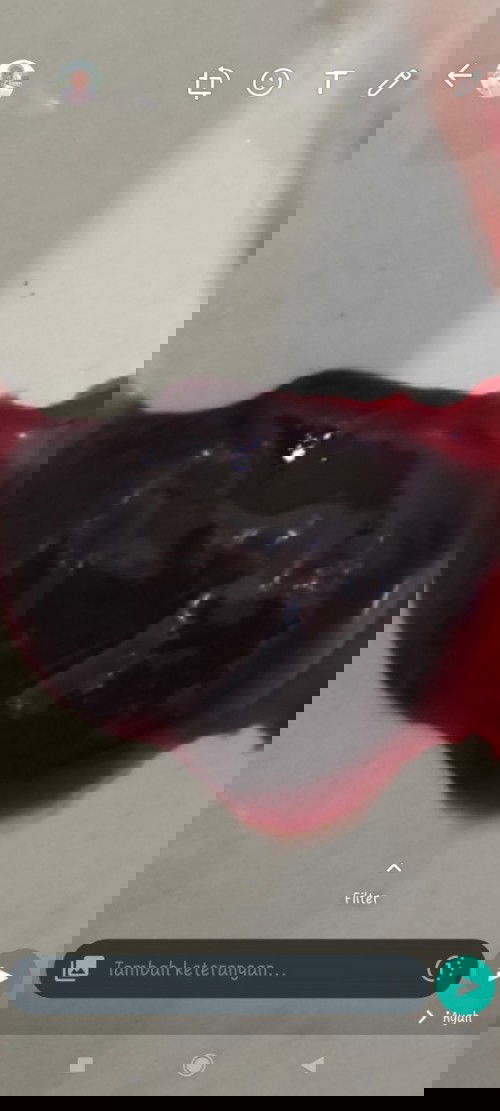 Kalau sudah merasakan kram, pusing, mual berkurang segera cek ya bunda, 7 minggu tepat hilang🙏😇🥲