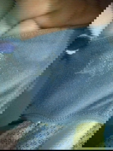 vaginal discharge