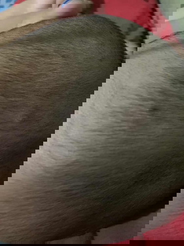 Ano po magandang home remedy