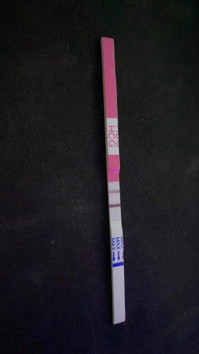 การตรวจที่ชิวมาก