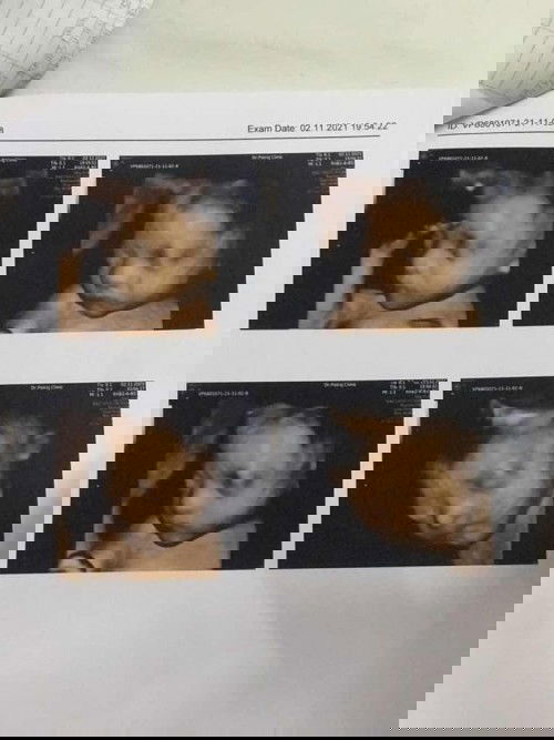 ทีมมกราคม65ลูกสาว🥰