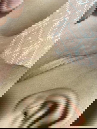 Help! What is this on my baby’s neck?