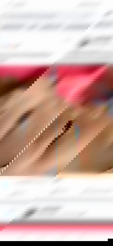 ผื่นขาวๆรอบตา