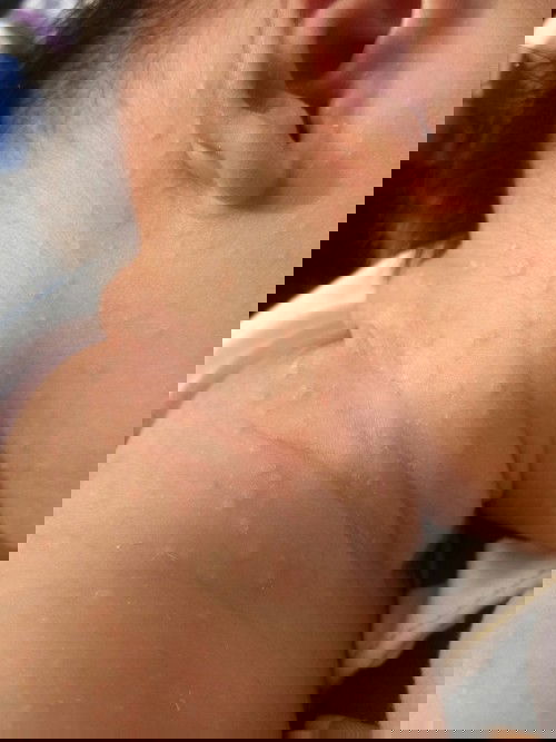 NEWBORN

pahelp naman mga mommies . anu po kaya itong pula pula ni baby .. kumakalat kasi sa katawan