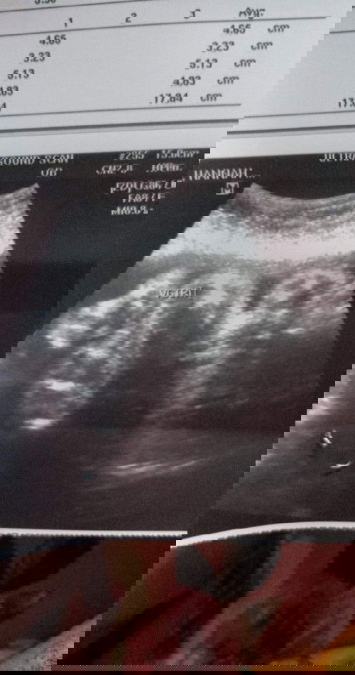 Ultrasound confirmation