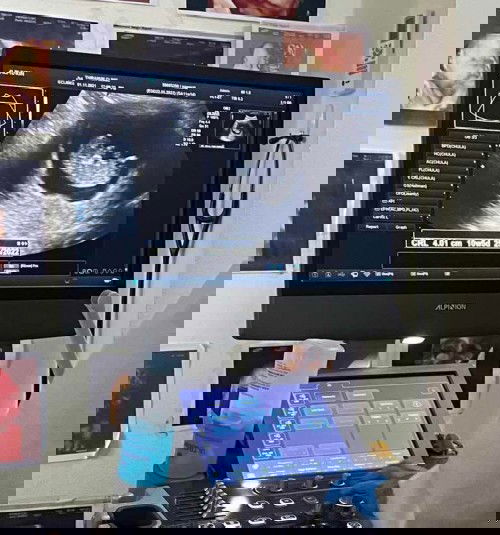 ท้องแรกก็จะตื่นเต้นมากๆเลยค่ะ👶🏻❤️