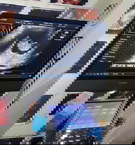 ท้องแรกก็จะตื่นเต้นมากๆเลยค่ะ👶🏻❤️