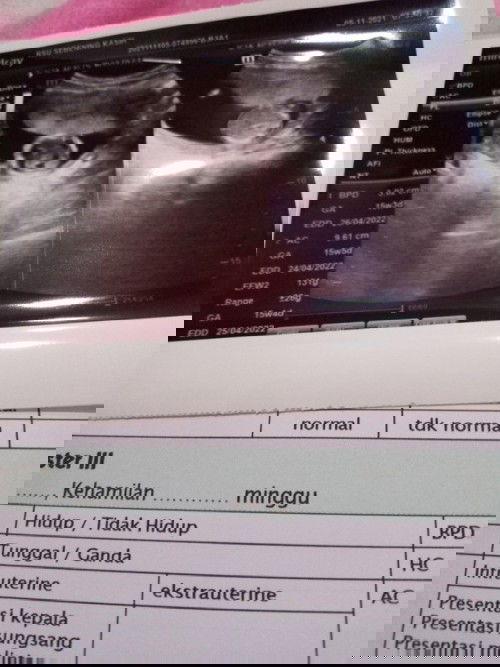 Pendapat bunda2 bagaimana? bingung ngejelasin sama mertua 🥺🥺🥺