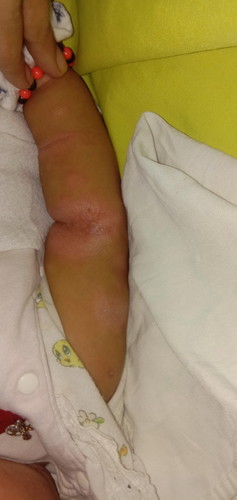 May alam po ba kayong gamot dito help naman kung may alam kayo tnx