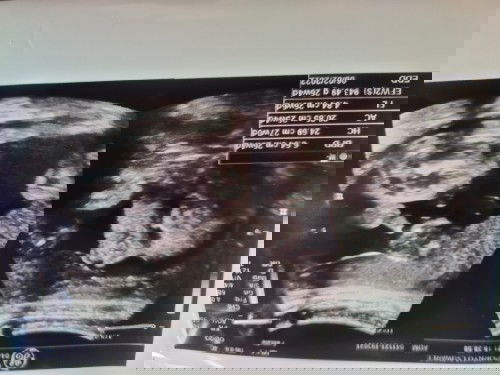 โอเค ดั้งโด่งมากลูก 💜 หนูมีจู๋นะค้าบบ 👦 คุณพ่อแอบเสียใจนิดหน่อย😂 น้ำหนักเกินเกณฑ์ไปแล้ว