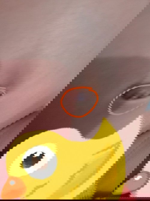 Pusat bayi 1 bulan ada bintil