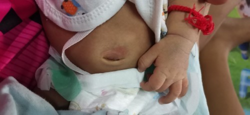 น้อง24วัน