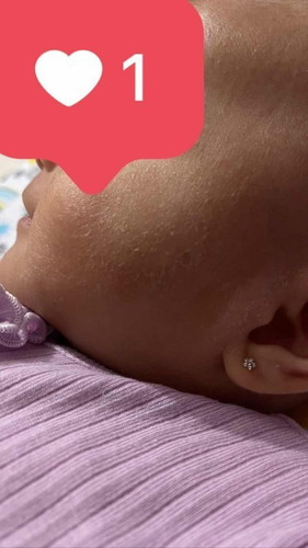 Pipi baby ku kering kasar dan terkelupas