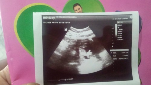 bunda semuanya, usia kehamilan 11 minggu apakah normal ya jika pembentukan tempurung Belum sempurna?