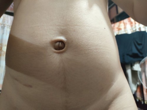 สะดือดำขึ้นเรื่อยๆ