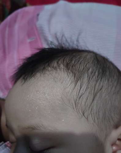 bayi keringetan