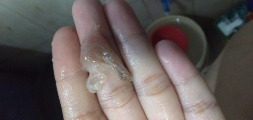 Mucus plug or normal discharge?