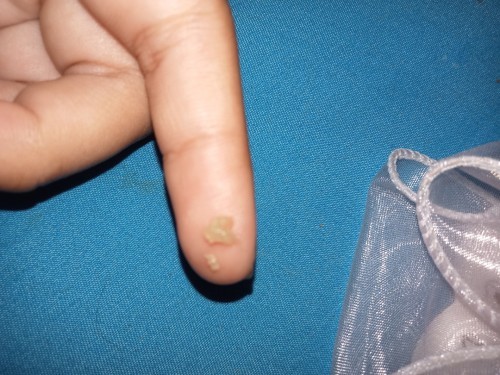 ไม่ได้ตั้งครรภ์