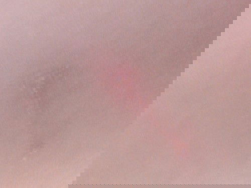 Con e bị gì v các mom