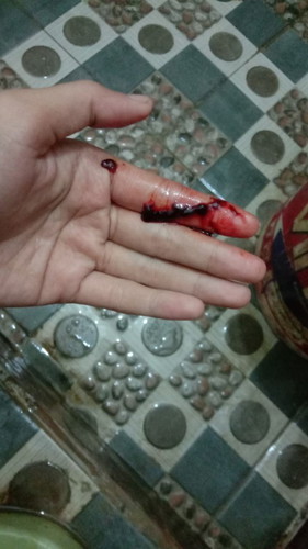 Maaf numpang nanya maaf jga aga jorok saya mau tanya ini keguguran apa bkn tpi darah ga keluar banya