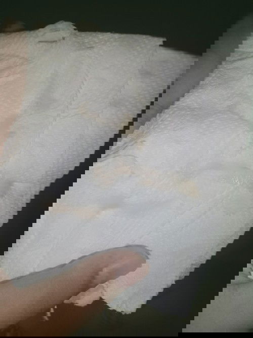 ปวดท้องมีมูก