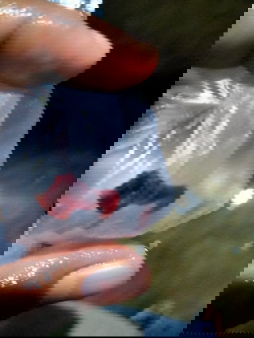 Keguguran tanpa tau hamil