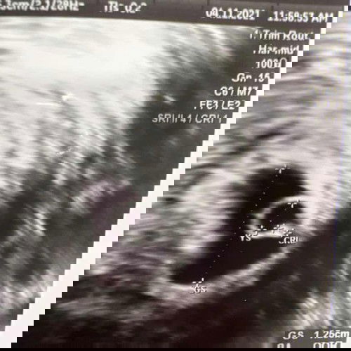 ช่วยดูหน่อยค่ะแม่ๆ