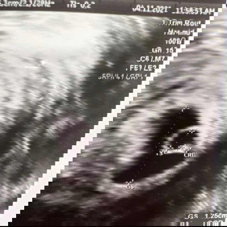 ช่วยดูหน่อยค่ะแม่ๆ