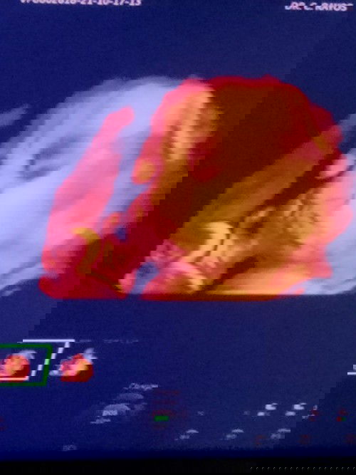 sana masagot po mga momshie