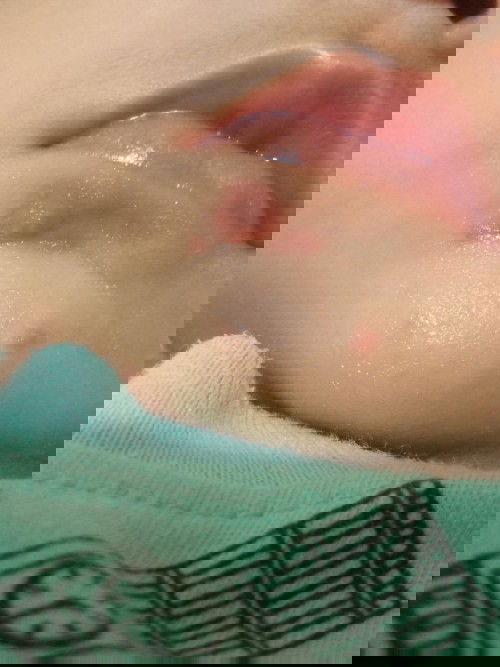 merah2 pada dagu bayi