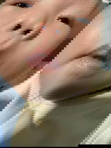 newborn lips skin crack/tear