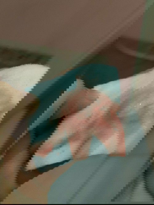 Flek darah di 40minggu