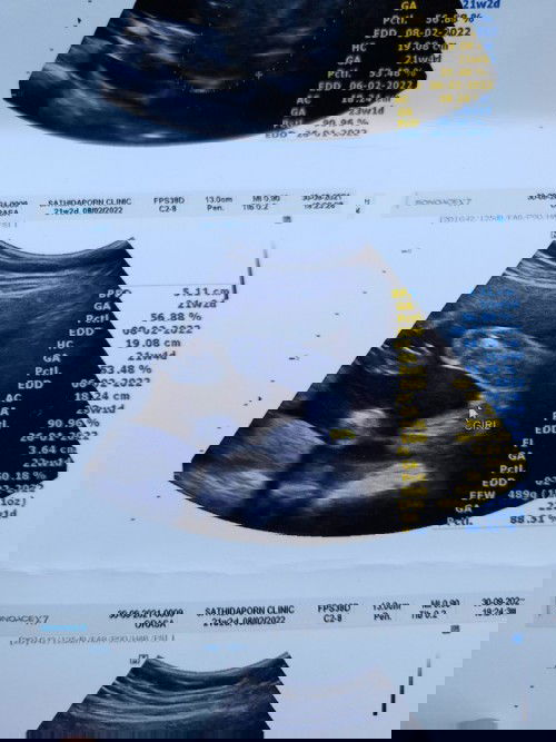 ขอคำชี้แนะจากเพื่อนๆหน่อยค่