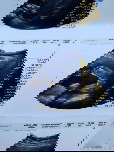 ขอคำชี้แนะจากเพื่อนๆหน่อยค่