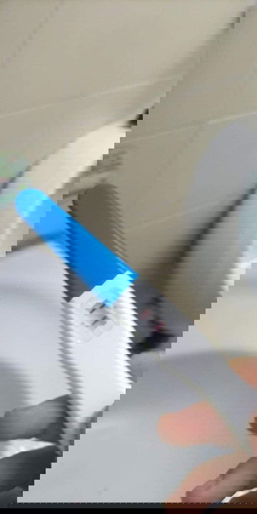 ผิดปกติไหม