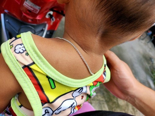 ผื่นแบบนี้ใช้อะไรดีค่ะ