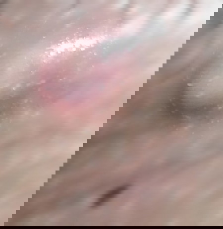 may bukol sa singit ano po kaya ito o sanhi nito? salamat po