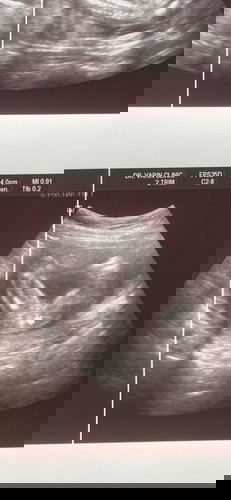 ทายเพศลูกหน่อยค่ะ