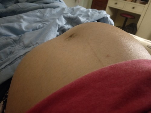 ลูกโก่งตัวบ่อยมาก
