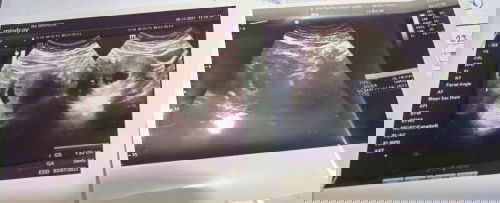 Hasil USG hamil kosong