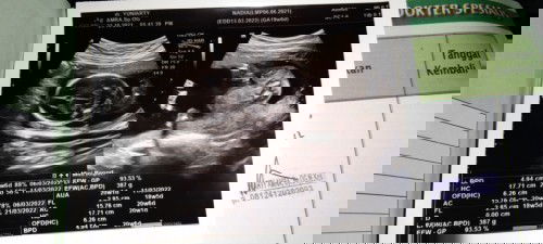 Mohon dibantu yah 😀