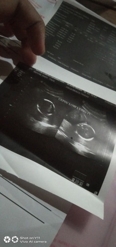 Low lying placenta