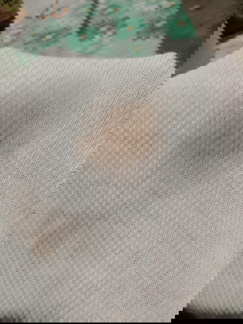 Normal lang po ba ??