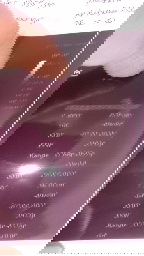 Berat badan bayi (efw)