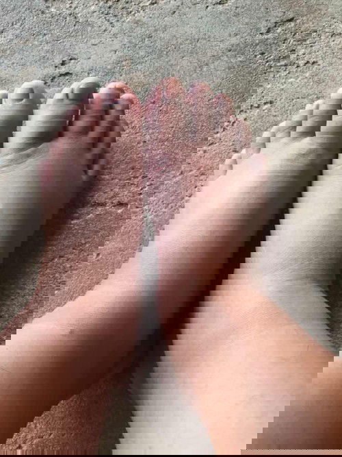 เท้าบวมมากสาเหตุเกิดจากอะไร