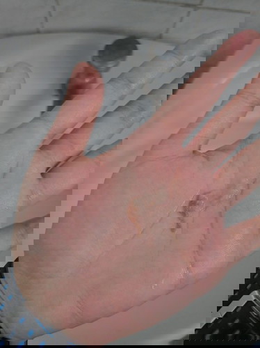 ตั้งครรภ์ได้ 10 สัปดาห์